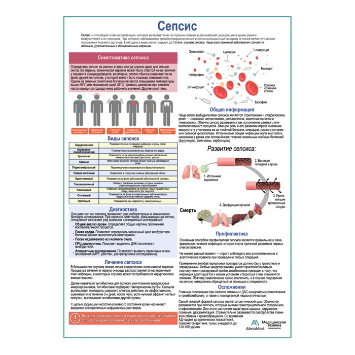 Сепсис, медицинский плакат А1+/А2+