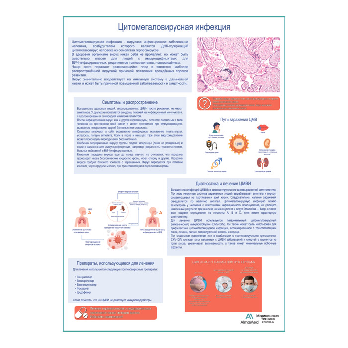 Цитомегаловирусная инфекция, медицинский плакат А1+/A2+