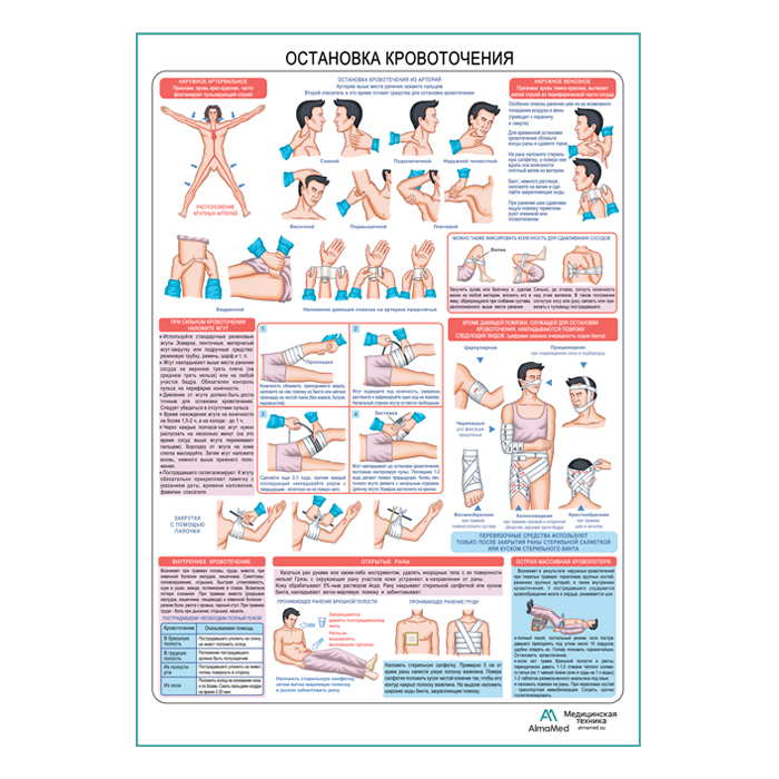 Остановка кровотечения, плакат глянцевый А1+/А2+