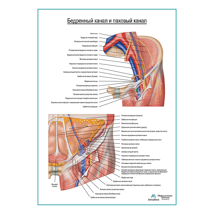 Бедренная канал и паховый канал плакат глянцевый А1+/А2+