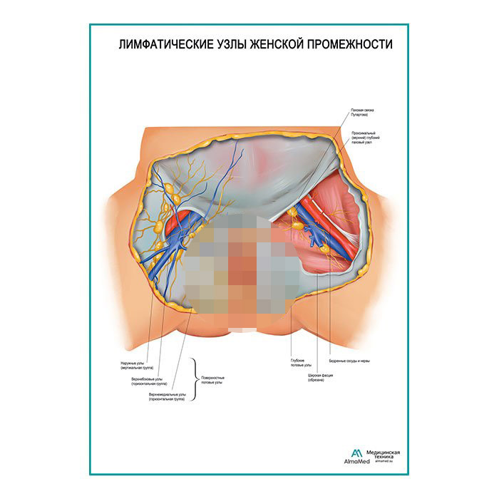 Лимфатические узлы женской промежности плакат глянцевый А1+/А2+