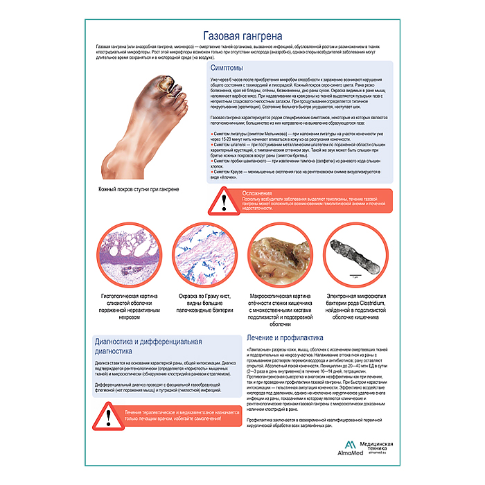 Газовая гангрена медицинский плакат А1+/A2+