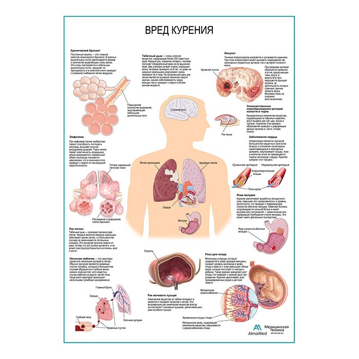 Вред курения плакат глянцевый А1+/А2+