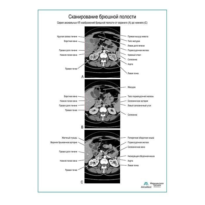Сканирование брюшной полости плакат глянцевый  А1+/А2+