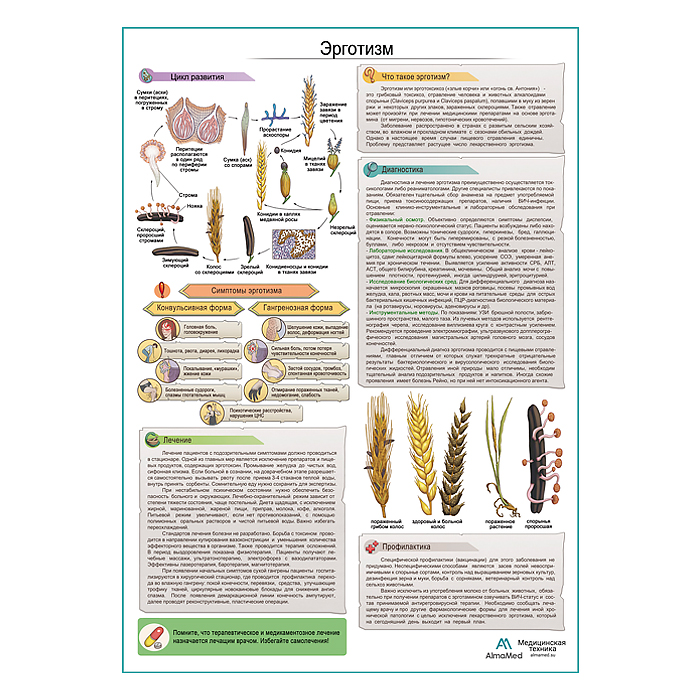 Эрготизм медицинский плакат А1+/A2+