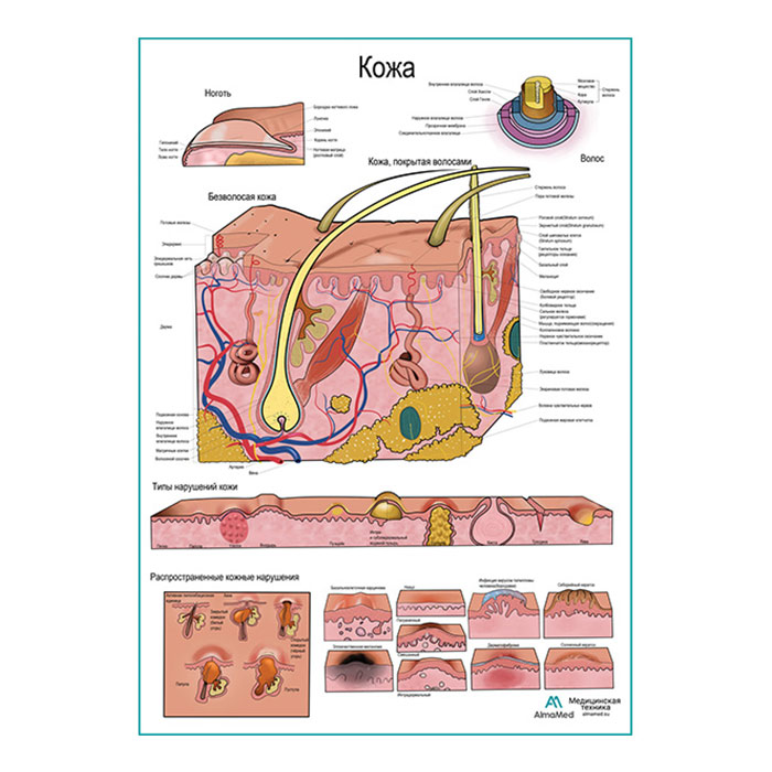 Кожа и типы нарушений, плакат глянцевый А1+/А2+