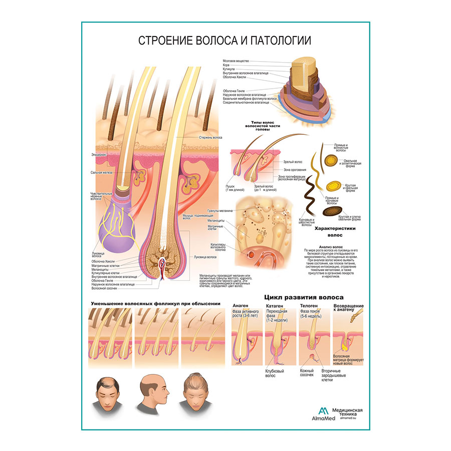 Строение волоса и патологии, плакат глянцевый А1+/А2+