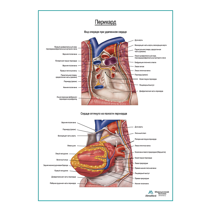 Перикард плакат глянцевый А1+/А2+